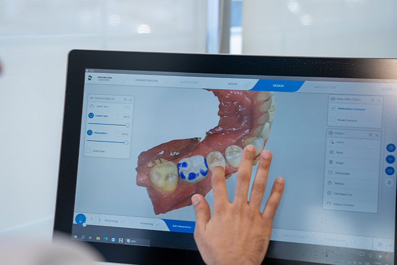 close up of doctor examining display for dental patient treatment