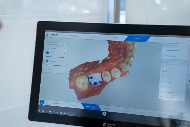 display of dental mouth during for patient treatment