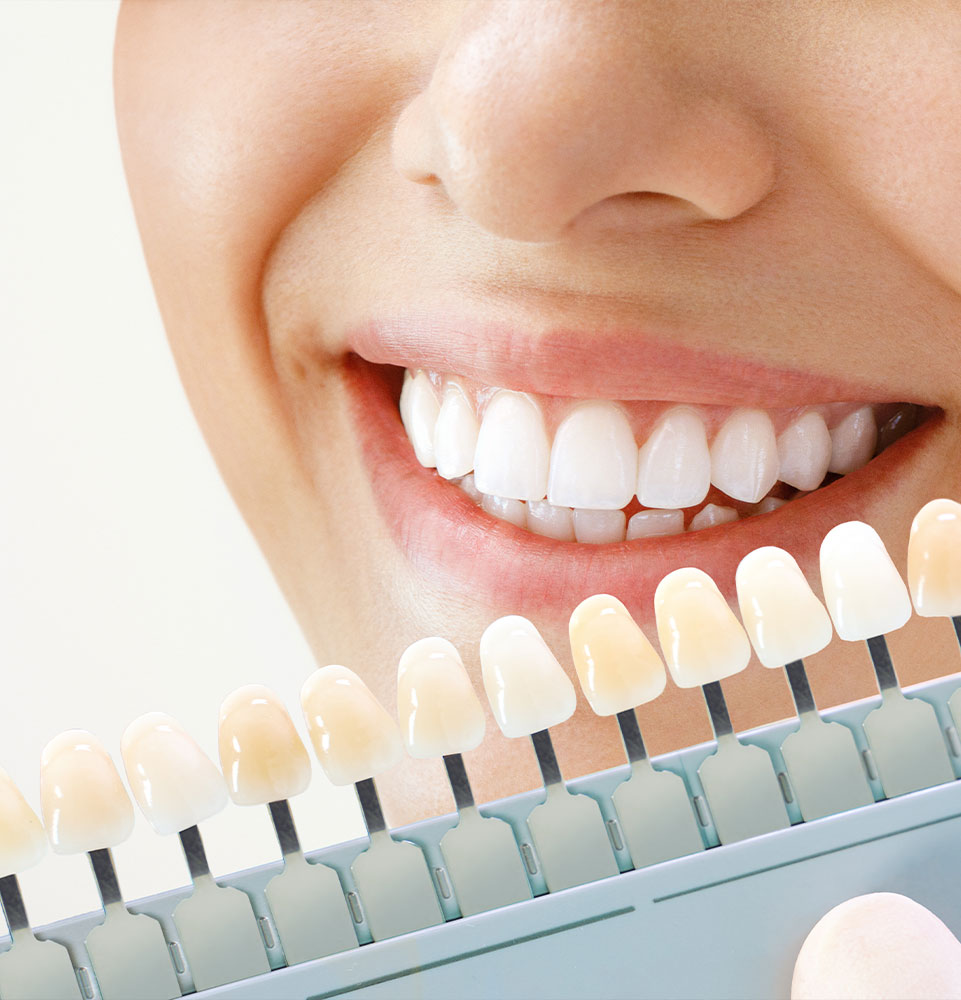 up close of comparing brightness in teeth bleaching for whitening